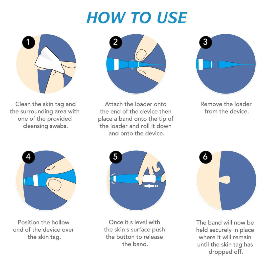 DermaFix™ – Remove Skin Tags Safely at Home